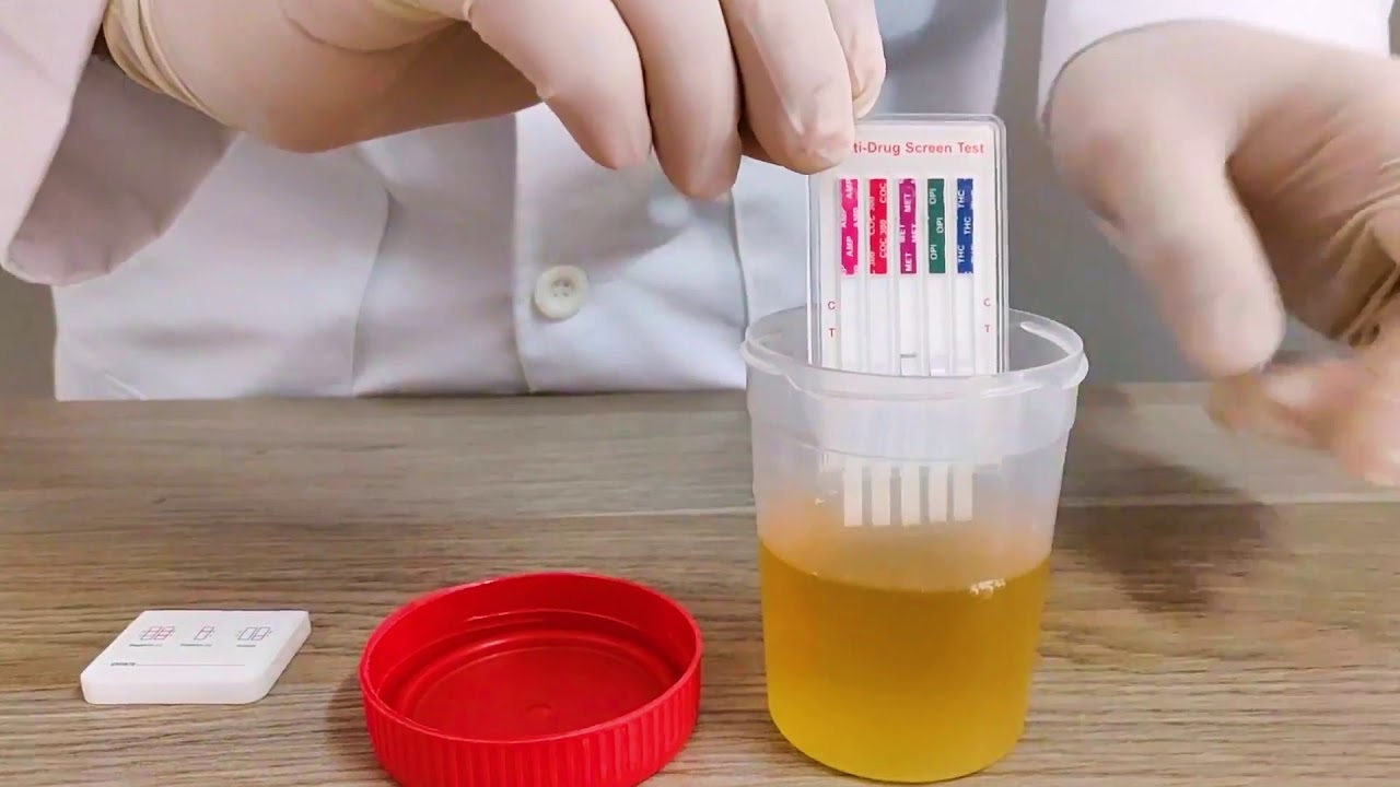 Formas de realizar la Prueba Antidrogas